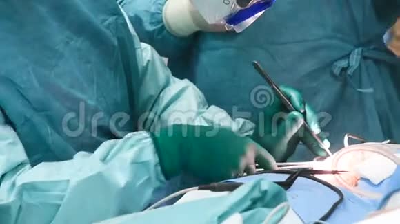 神经外科医生做手术切除脑瘤视频的预览图