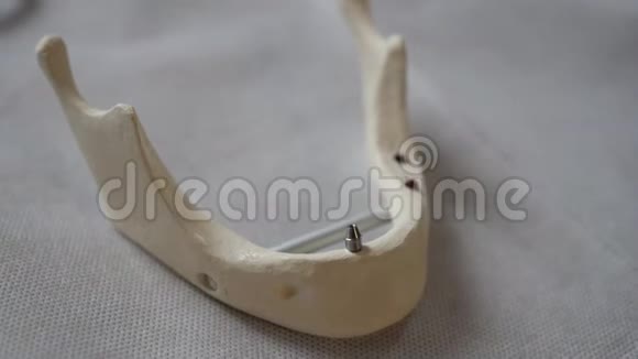 人体下巴的塑料布局视频的预览图