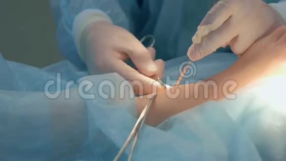 外科医生在手术中缝合脚踝去除湿瘤后缝合整齐视频的预览图