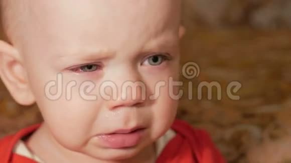 有过敏症的漂亮宝宝红肿的眼睛那个男孩哭着和这种疾病作斗争孩子一年关闭视频的预览图