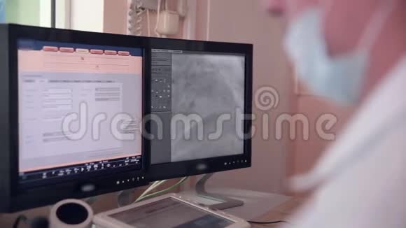 医生探索真正心跳的超声波电脑屏幕上超声检查视频的预览图