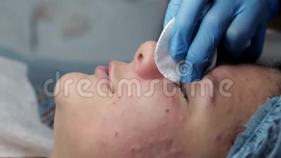 美容师在进行机械面部清洁时对鼻部进行清洁视频的预览图
