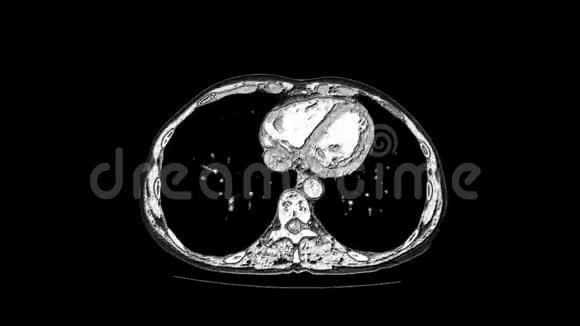 腹腔胃肠道膀胱的MRI对比视频的预览图
