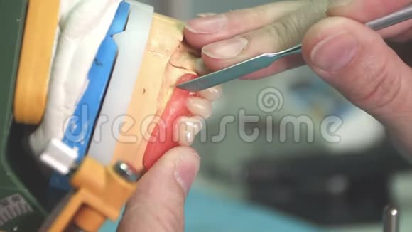 实验室技术人员清除种植牙的缺陷视频的预览图