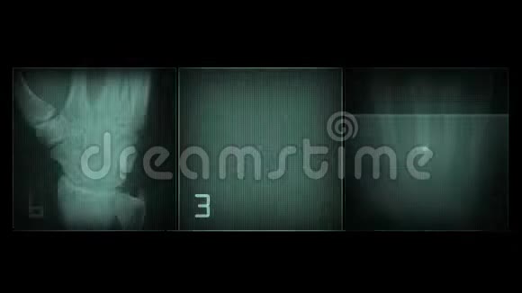 动画x射线模拟身体部位视频的预览图
