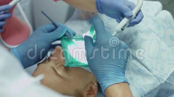 使用现代牙科设备填充病人生病牙齿的过程视频的预览图
