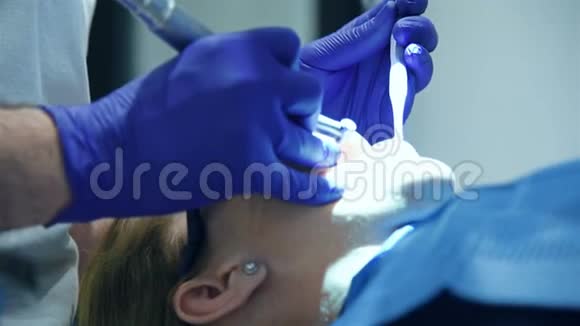 牙医执行医疗操作视频的预览图