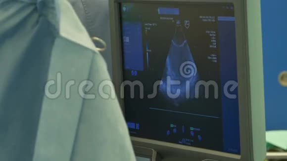 手术室超声监护仪视频的预览图