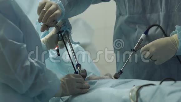 外科医生做手术视频的预览图