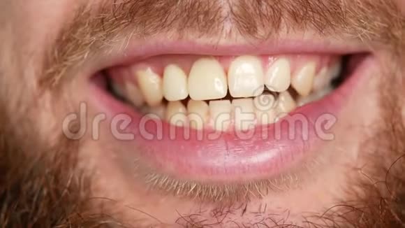 嘴的特写一个男人展示他的假牙视频的预览图