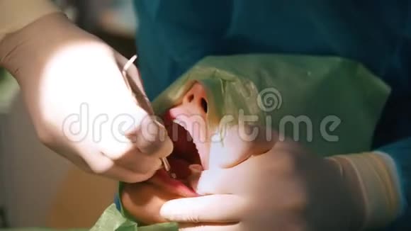 牙科医生在口腔外科手术中执行一个程序视频的预览图