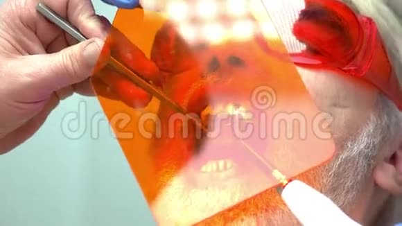 口腔医生使用紫外线视频的预览图