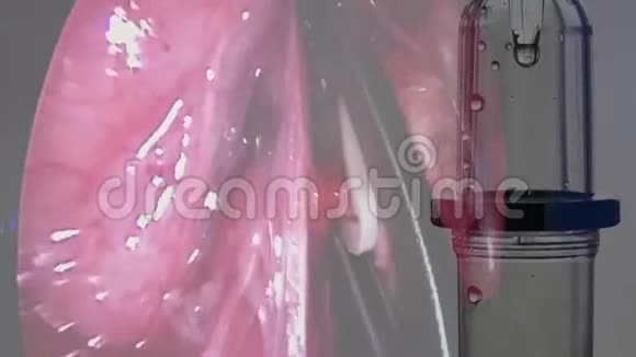 心脏手术的滴管视频的预览图