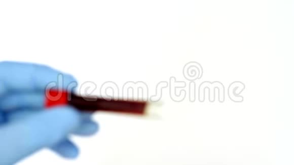 概念血液测试双手戴蓝色手套拿着真血管视频的预览图
