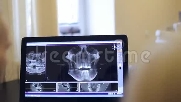 医患讨论三维可视化模型视频的预览图