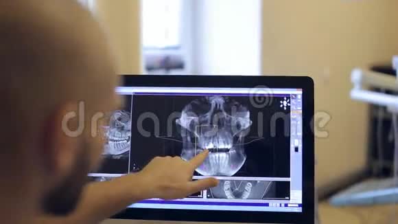 医患讨论三维可视化模型视频的预览图