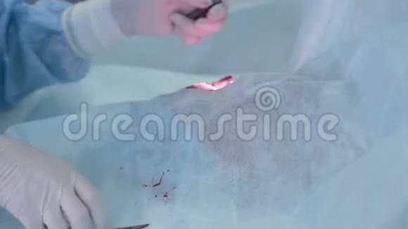 使用消毒设备进行外科手术时双手紧闭视频的预览图