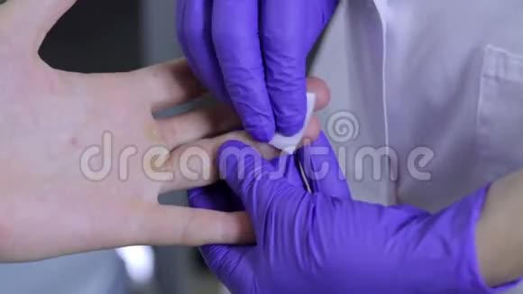 护士清洁病人手指抽血视频的预览图
