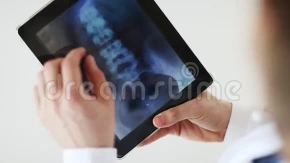 在平板电脑上进行x光扫描的医生视频的预览图