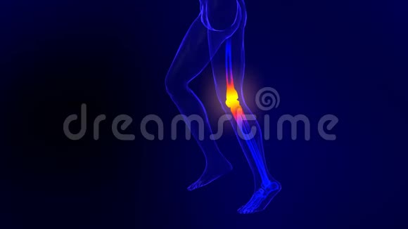 膝关节疼痛的X线骨架动画视频的预览图
