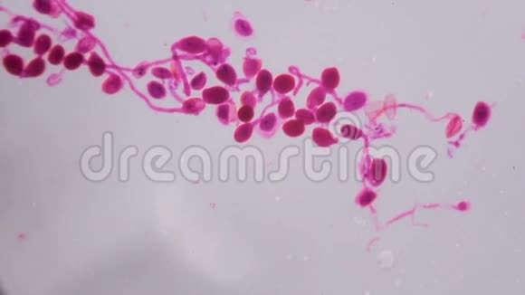 雪莲花在显微镜下成熟花药视频的预览图
