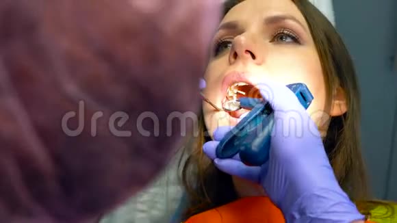 做过补牙手术的女人视频的预览图