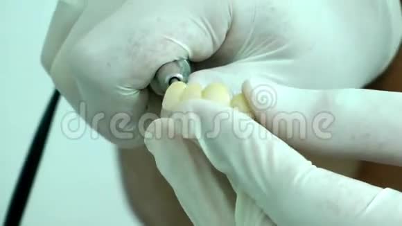 牙科用锆石瓷牙形状视频的预览图
