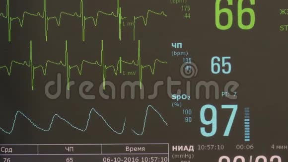 术中监护仪心律及脉搏图像的心电图视频的预览图