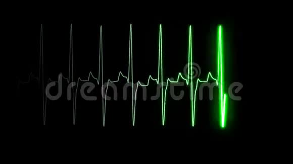屏幕上的心跳脉冲信号视频的预览图