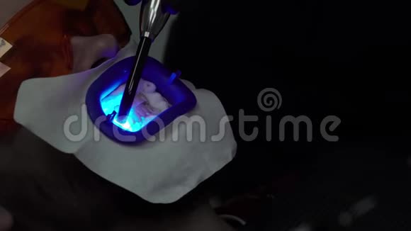 紫外线灯患者牙齿美白视频的预览图