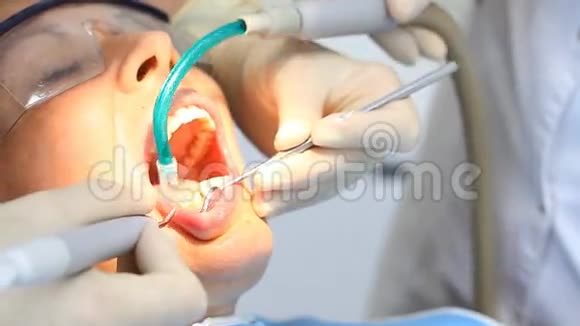 牙医使手术成为病人视频的预览图