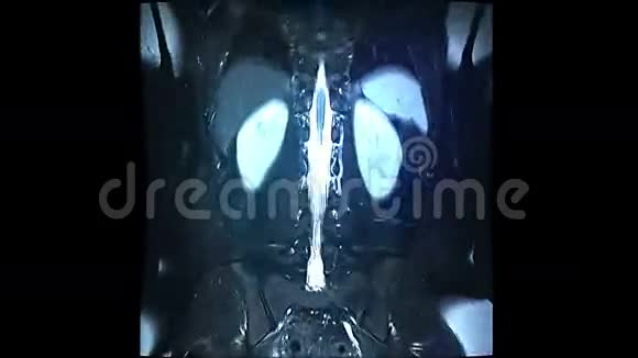 脊柱核磁共振扫描视频的预览图