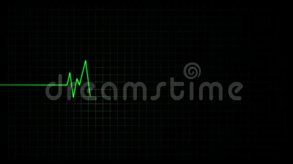 心率监护仪视频的预览图