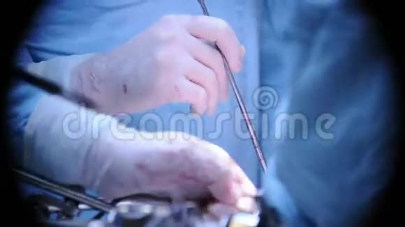 动手做手术的医生视频的预览图
