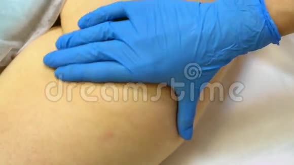 细胞炎医生的手给臀部女性按摩视频的预览图