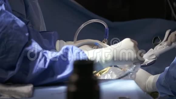 腹腔镜肺手术中的外科医生视频的预览图