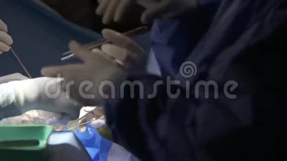 腹腔镜肺手术中的外科医生视频的预览图