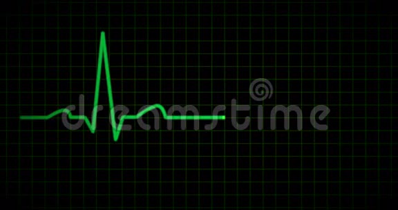 心电图或心电图线绿色视频的预览图
