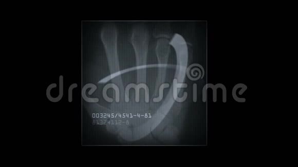 4k人体手指骨扫描技术医学X射线数据医学研究身体健康视频的预览图