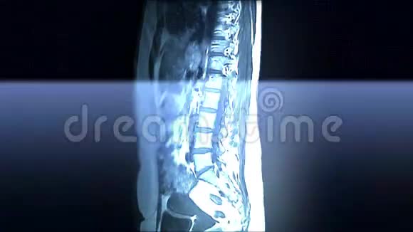 脊柱核磁共振扫描视频的预览图