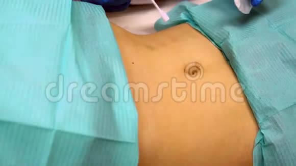 医生在手术前清洗胃皮视频的预览图