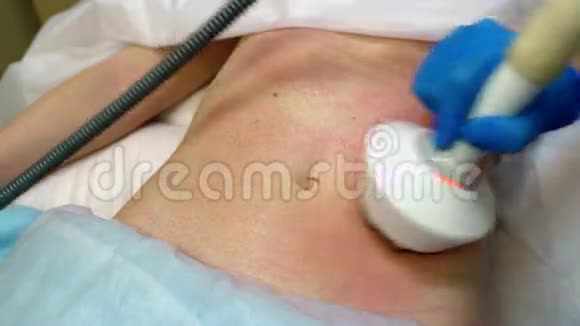 对抗蜂窝组织皮肤腹部恢复视频的预览图