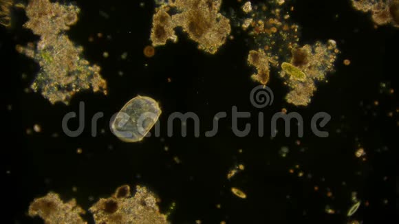 显微镜下的微生物视频剪辑视频的预览图