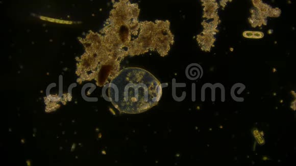 显微镜下的微生物视频剪辑视频的预览图