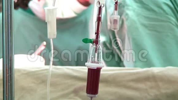 手术室滴血视频的预览图