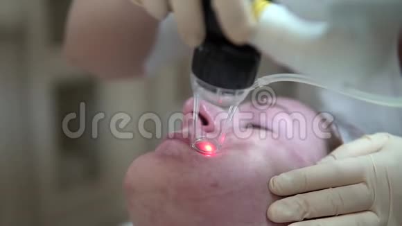 激光面部皮肤在医疗诊所重铺视频的预览图