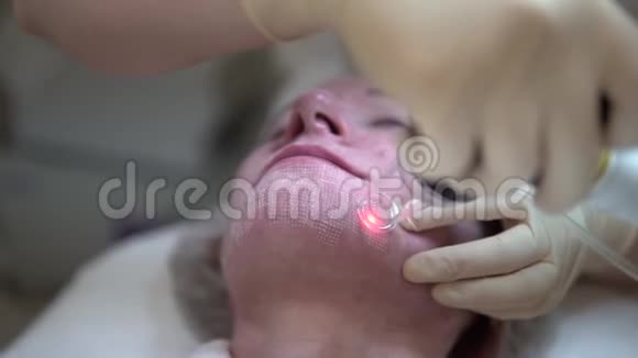 激光面部皮肤在医疗诊所重铺视频的预览图