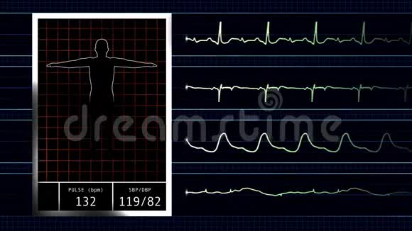 心率监护仪视频的预览图