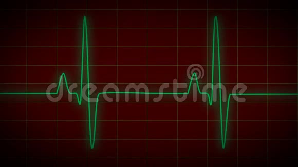 心脏监视器心电图视频的预览图