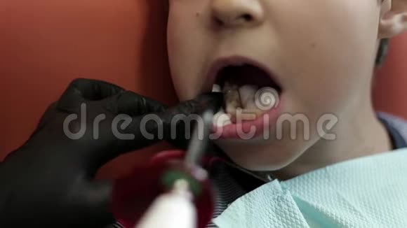 孩子是牙医视频的预览图